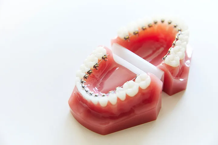 大人のための全体矯正のイメージ