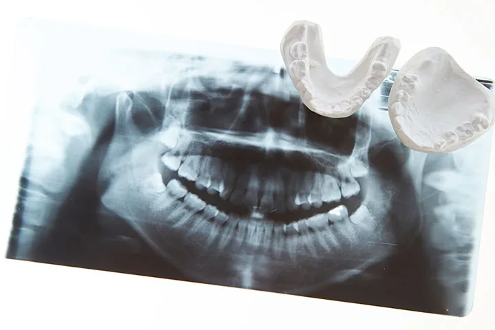 手術が必要かどうかの判断基準