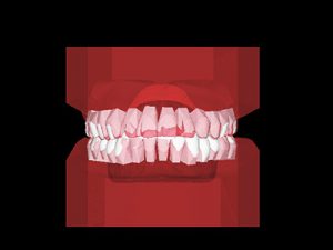 3Dシミュレーション
