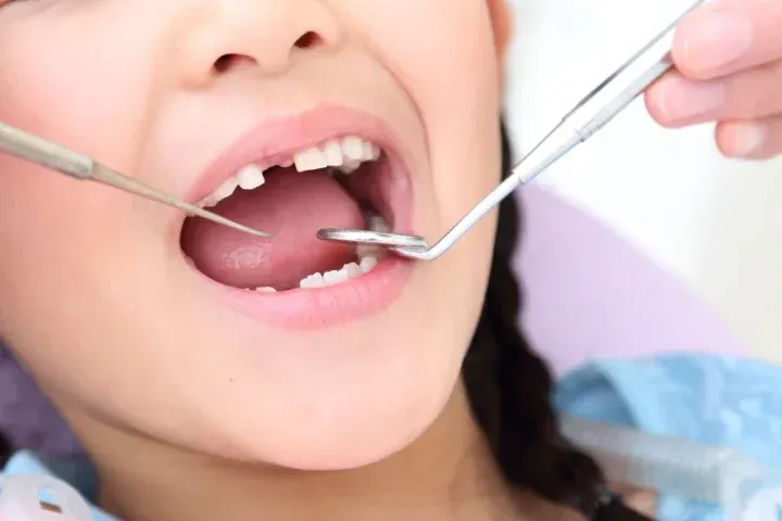 歯科治療をする様子